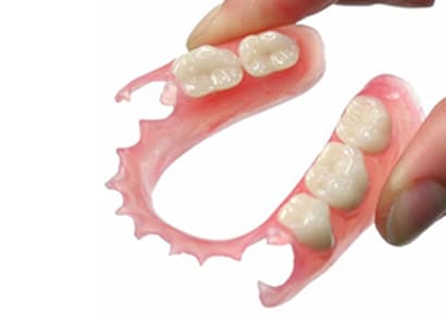 ノンクラスプデンチャー