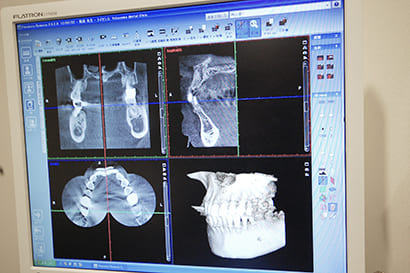 CTスキャンによる診査・診断